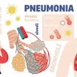 Pneumonia Penyakit Serius