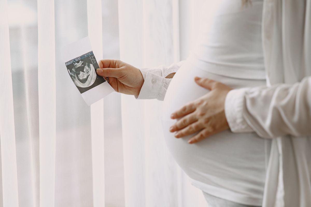 Bayi Lahir Prematur